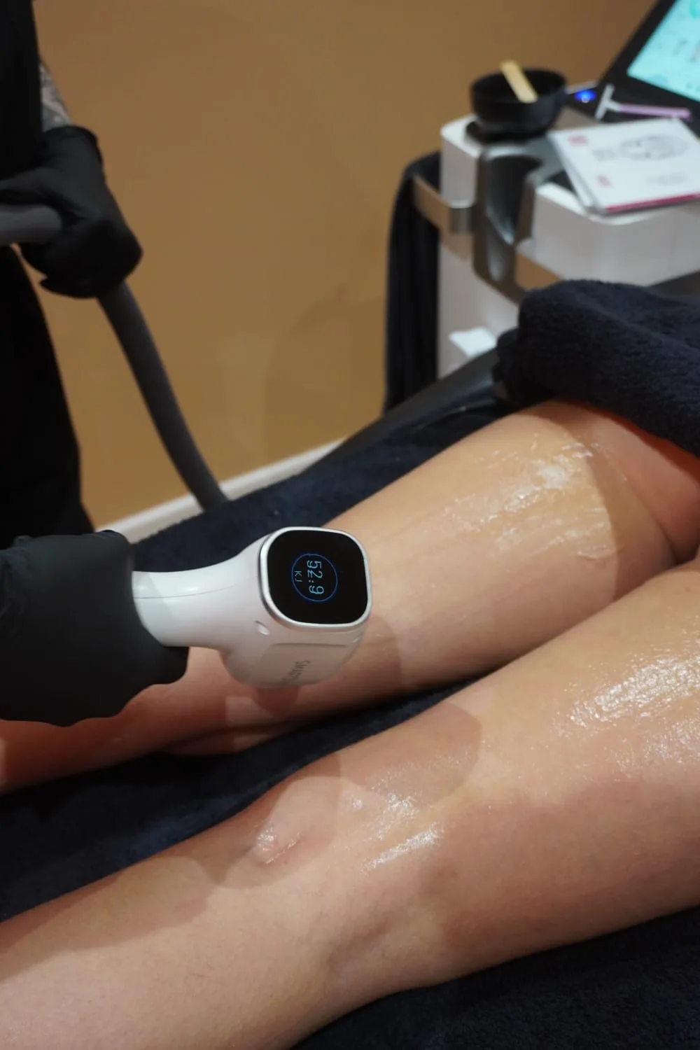 Laser hair removal treatment on legs at Hull clinic